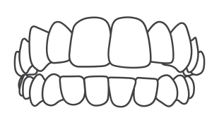 開咬イラスト