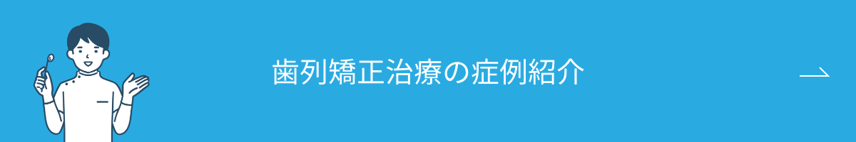 歯列矯正治療の症例紹介