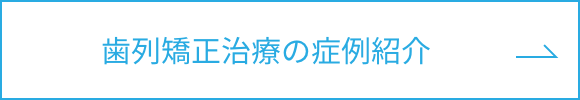歯列矯正治療の症例紹介